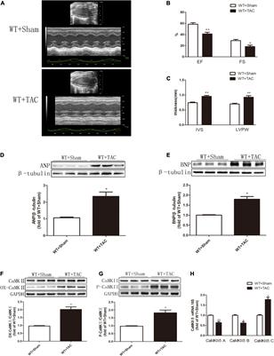 Ca2+/Calmodulin-Dependent Protein Kinase II Regulation by RIPK3 Alleviates Necroptosis in Transverse Arch Constriction-Induced Heart Failure